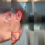 Mulher agredida por amigo do filho desmaiou por estrangulamento