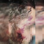 Motorista de app é espancado no DF após briga de trânsito